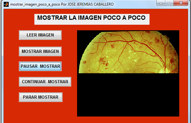 ojo